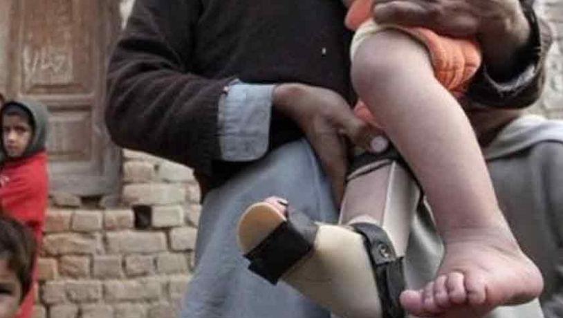 Pakistan Reports First Polio Case of 2026 from Sindh