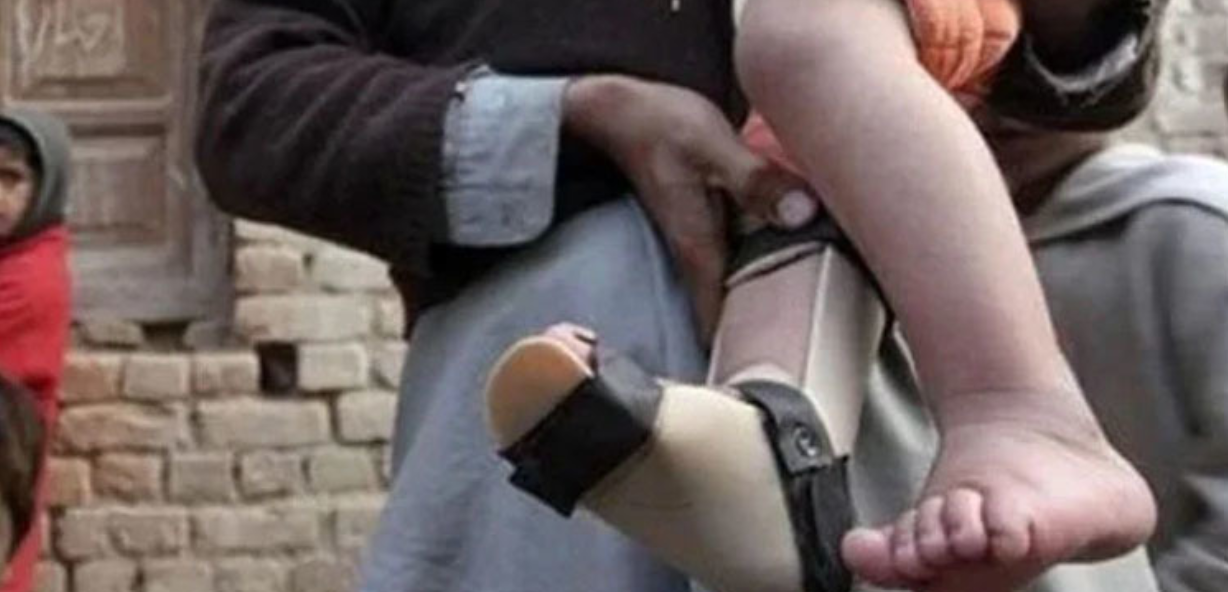 Pakistan Confirms Two New Polio Cases in KP, 2026 Tally Rises to Three